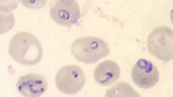 Babesia parasites in red blood cells on a stained blood smear.