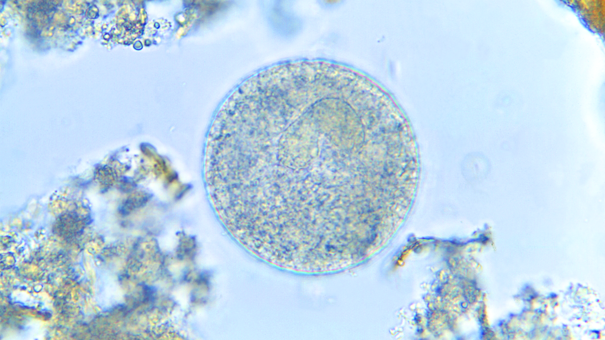 Balentidium Restored CDC | Clinical Treatment of Balantidium coli infection ...