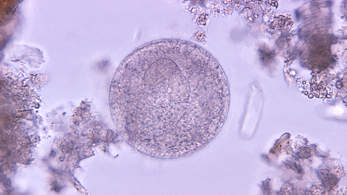 Balantidium coli parasitic cyst