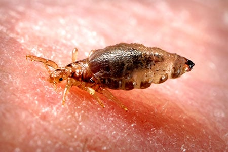 Body louse on human skin
