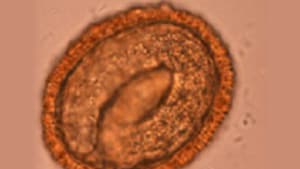 Ebryonated B. procyonis egg.