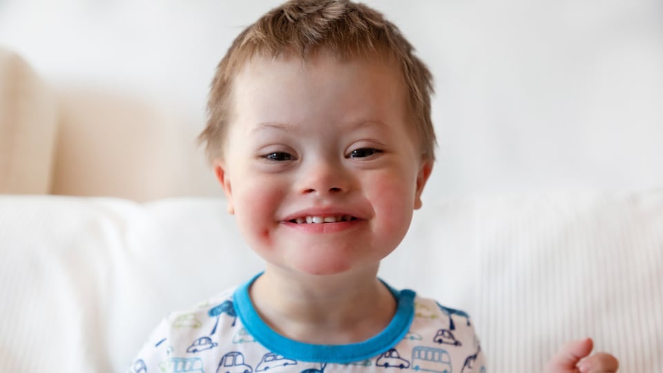 Niño pequeño con síndrome de Down sonriendo.