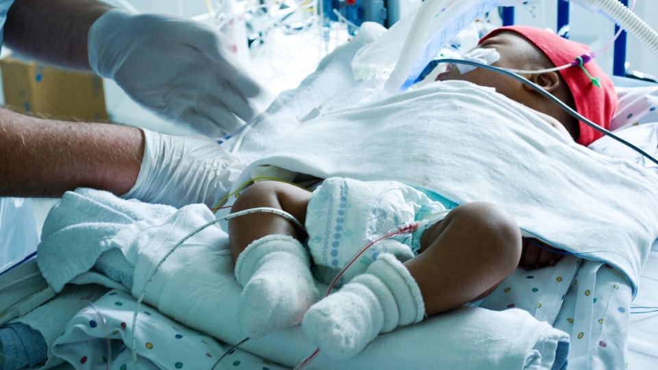 Recién nacido en el hospital con monitores y un tubo para respirar.