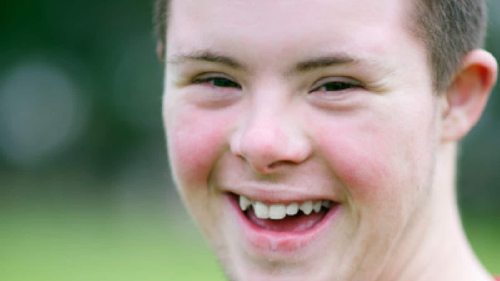 Up-close image of the smiling face of a teenager with Down syndrome.
