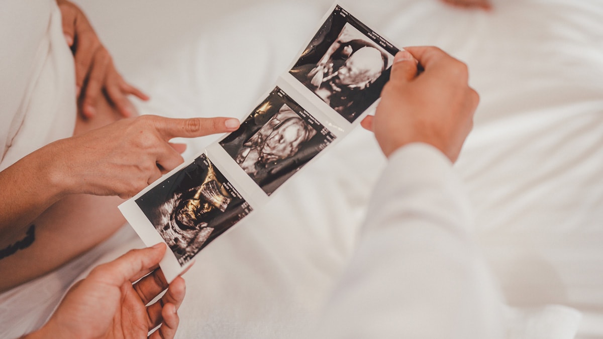 Doctor showing three sonogram images to pregnant woman