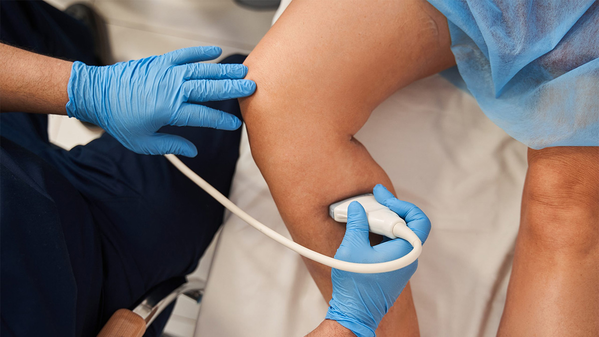 Restored CDC | Testing and Diagnosis for Venous Thromboembolism | Venous Thromboembolism (Blood Clots) | CDC