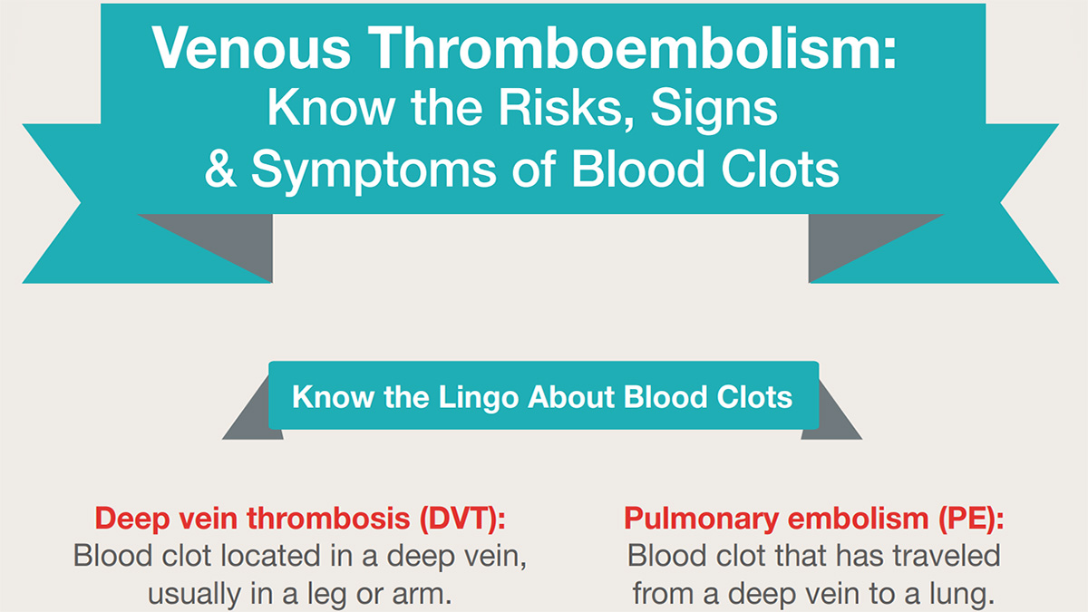 Know the Risks, Signs & Symptoms of Blood Clots Infographic | Venous ...