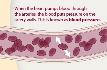 When the heart pumps blood through the arteries, the blood puts pressure on the artery walls. This is known as blood pressure.
