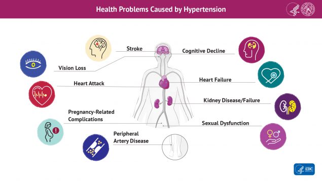 Effects of high blood pressure on the body: stroke, cognitive decline, vision loss, heart attack, heart failure, pregnancy-related complications, kidney disease or failure, peripheral artery disease, and sexual dysfunction.