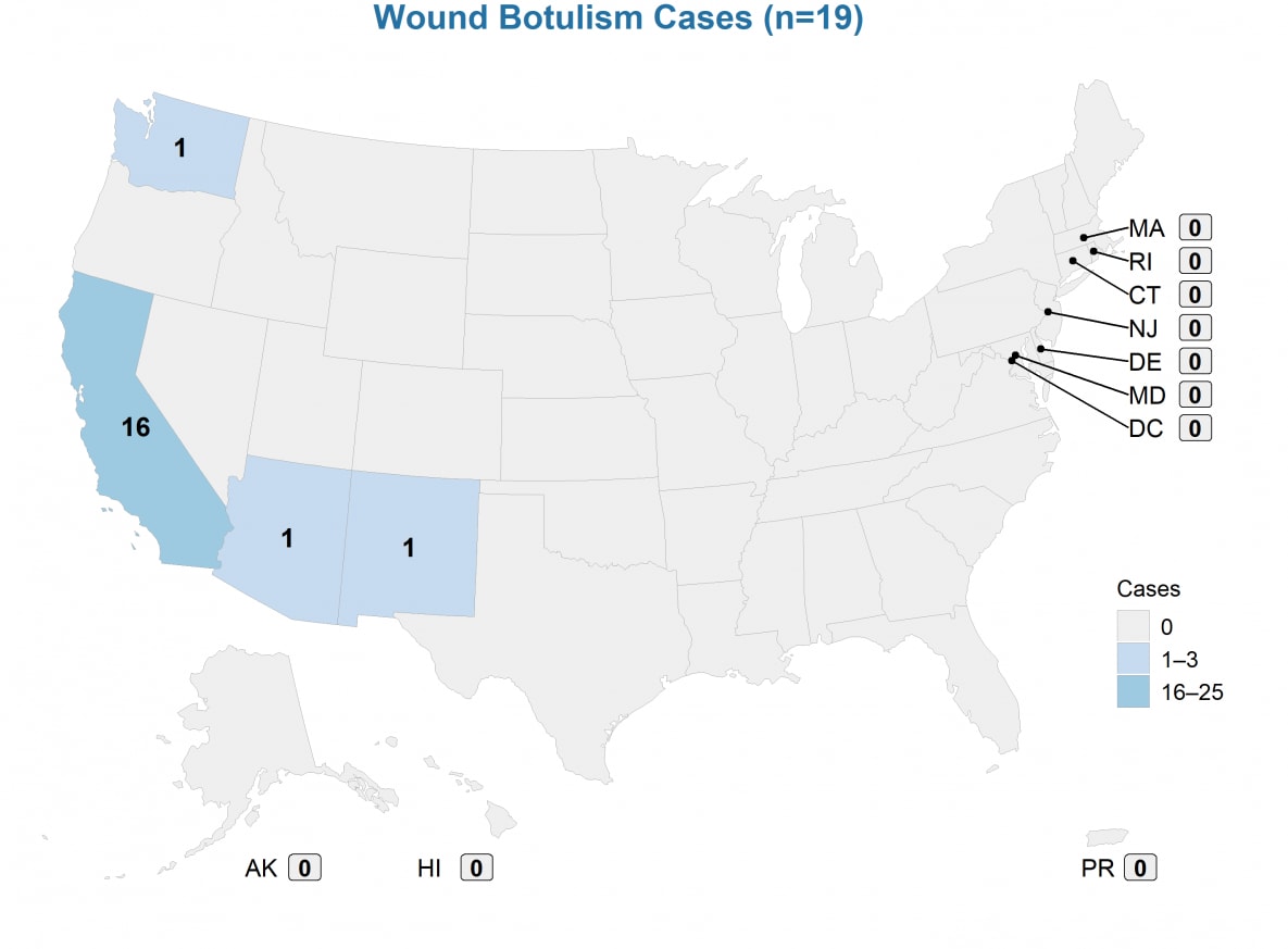 Nineteen wound botulism cases were reported from four states — 16 from California, and 1 each from Arizona, New Mexico, and Washington.