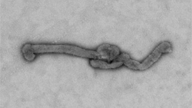 A Bourbon virus isolate under a microscope in a negative stain. The virus is long and in the photo is shown horizontally with a knot in the middle.