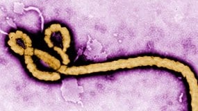Enlarged photo of the Ebola virus.