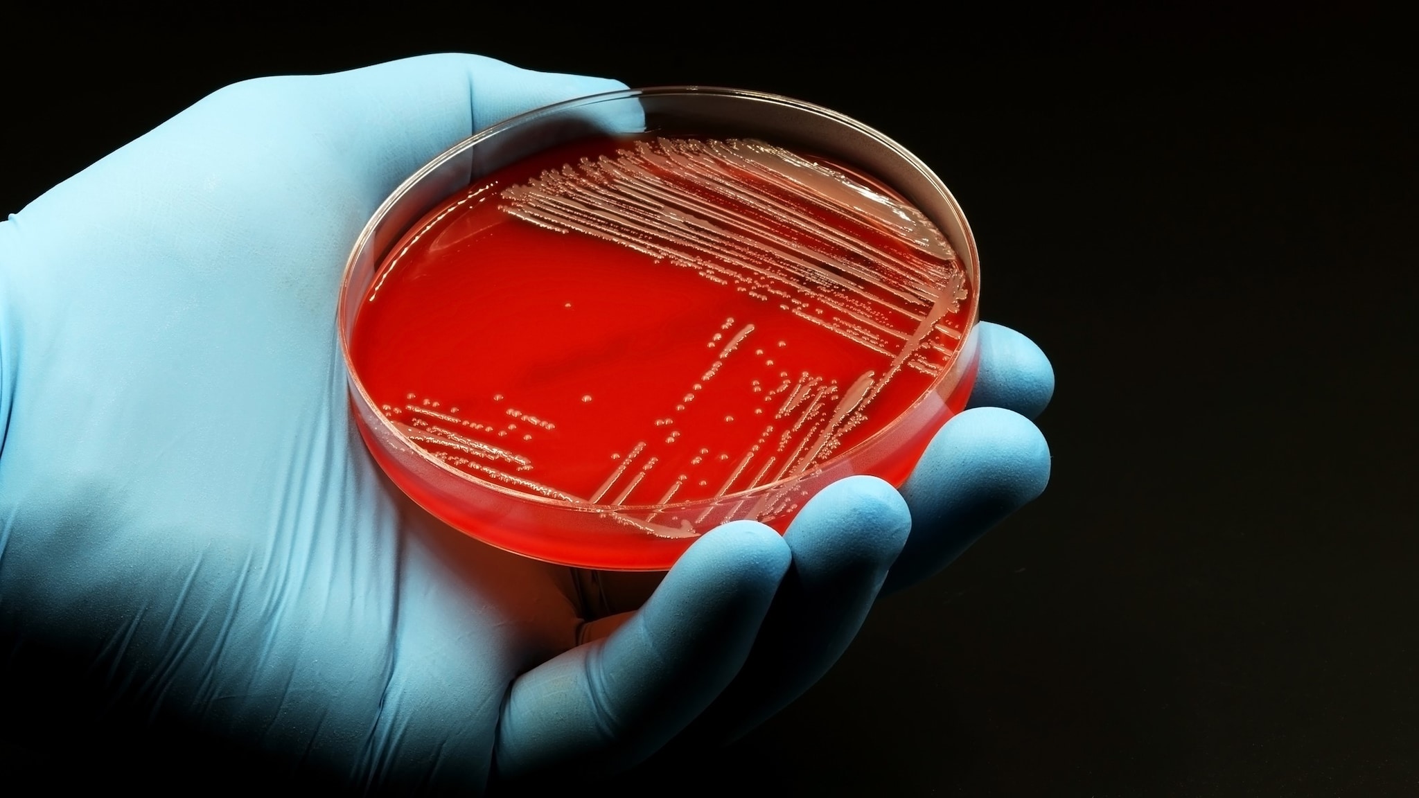 A hand with a blue glove on holding a petri dish with bacteria growing on its red medium inside.