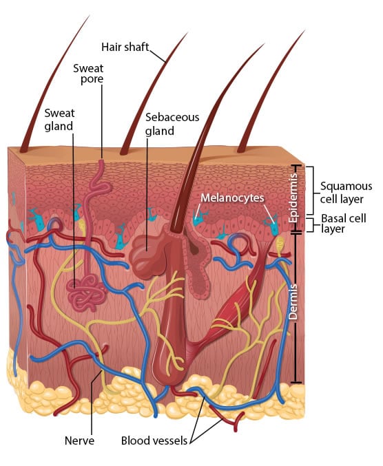 An illustration of the skin anatomy showing the basal and squamous cell layers and melanocytes.