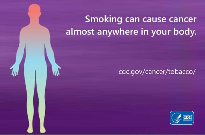Smoking can cause cancer almost anywhere in your body. cdc.gov/cancer/tobacco/
