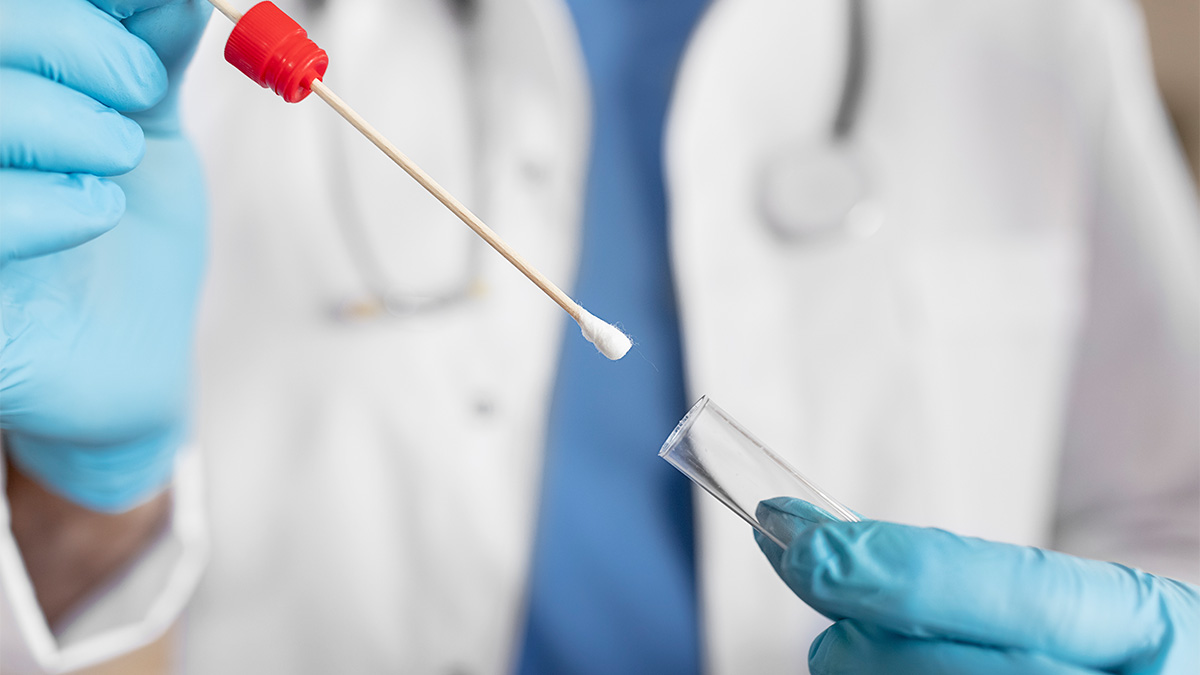 Candida Swab Labcorp at Wilford Shaw blog