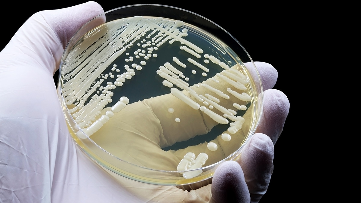 Photo of a Petri dish with C. auris