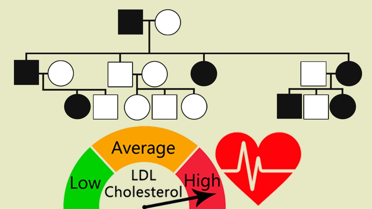 A pedigree with a graph for LDL Cholesterol from Low to High with an arrow on High and a heart.