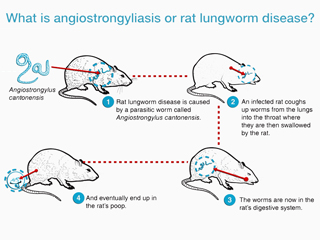 Rat lungworm diseases