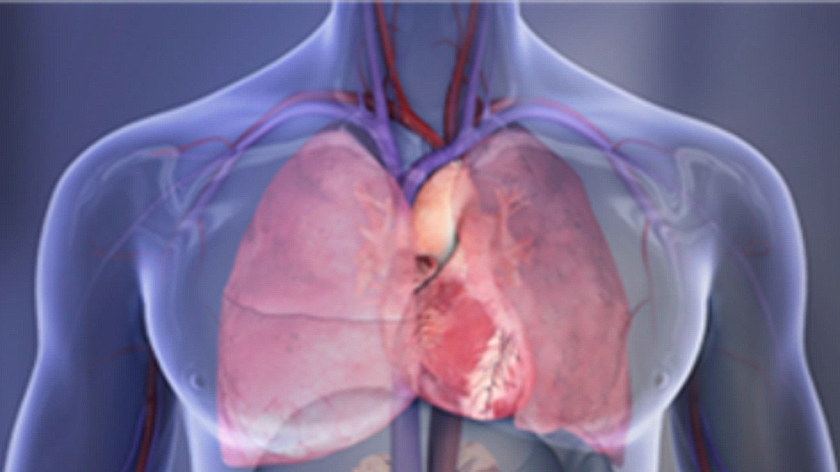 Cardiovascular Disease | Chronic Disease Indicators | CDC