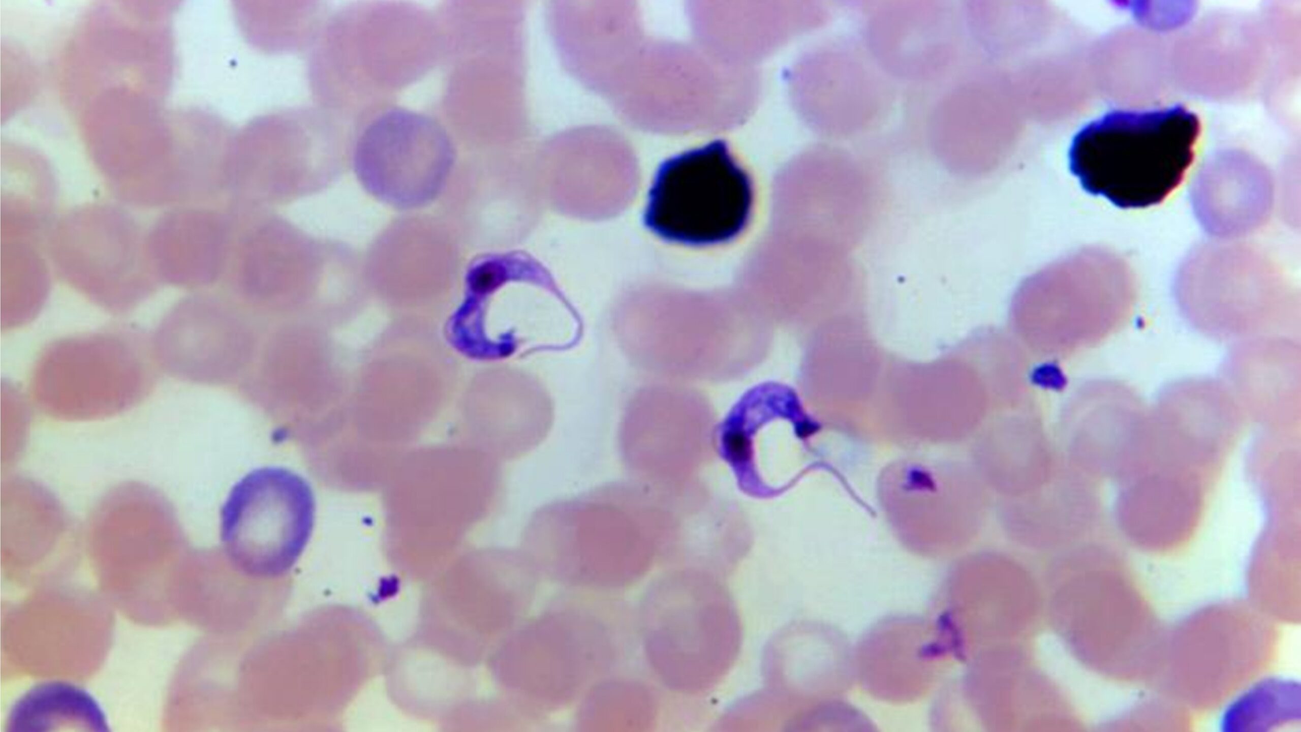 Magnified view of the Chagas parasite in a blood smear.