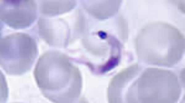 Trypanosoma cruzi parasite (trypomastigote) in a thin blood smear
