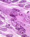 Esta microfotografía muestra las inclusiones intranucleares producidas por el virus de la varicela multiplicándose en un cultivo de tejidos; aumento de 500X.