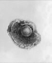 Micrografía electrónica de un virus de la varicela (chickenpox).
