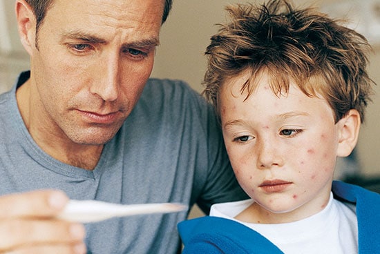 Father taking temperature of son with signs of chickenpox rash.