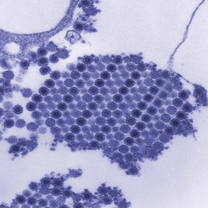 This digitally colorized transmission electron microscopic (TEM) image depicts numerous Chikungunya virus particles.