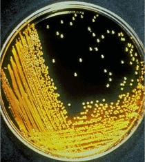 Vibrio cholerae growing on TCBS agar plate