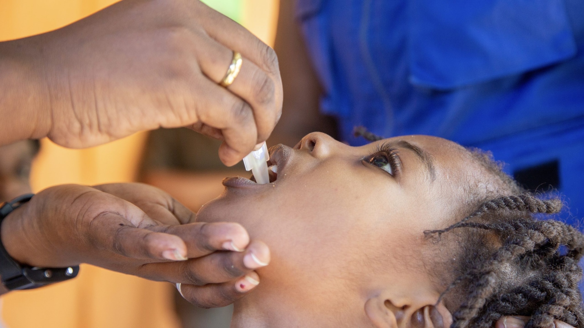 Child receives oral cholera vaccine