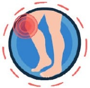 knee arthritis