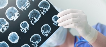 Medical expert reviewing images of head