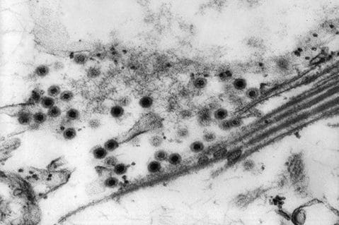 Transmission electron microscopic (TEM) image of Colorado tick fever virus