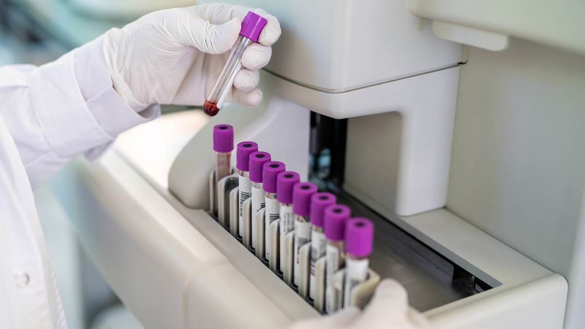 Genetic Testing for Lynch Syndrome | Hereditary Colorectal (Colon ...