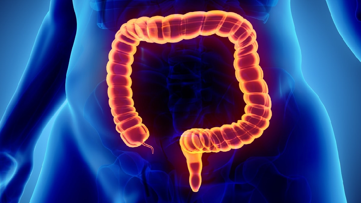 Medical illustration of the colon