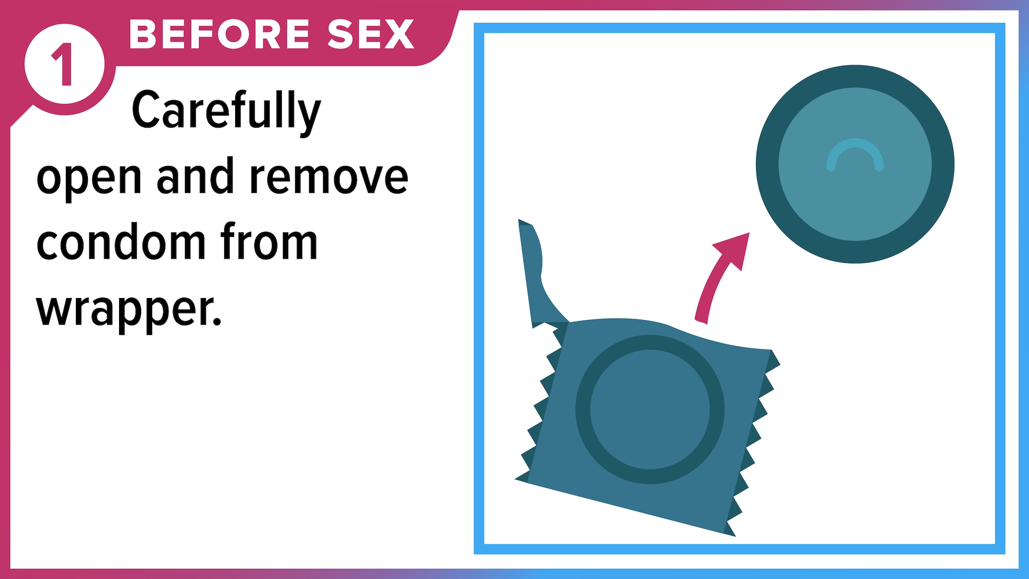 A condom removed from condom wrapper. Before sex, carefully open and remove condom from wrapper.