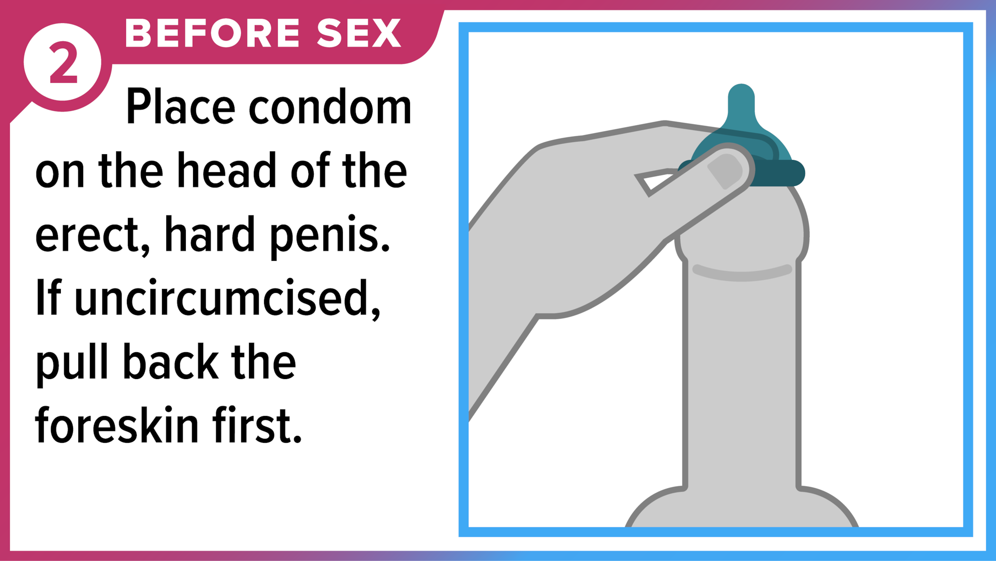 Hand placing condom on tip of penis. Before sex, place condom on the head of penis. If uncircumcised, pull back the foreskin first.