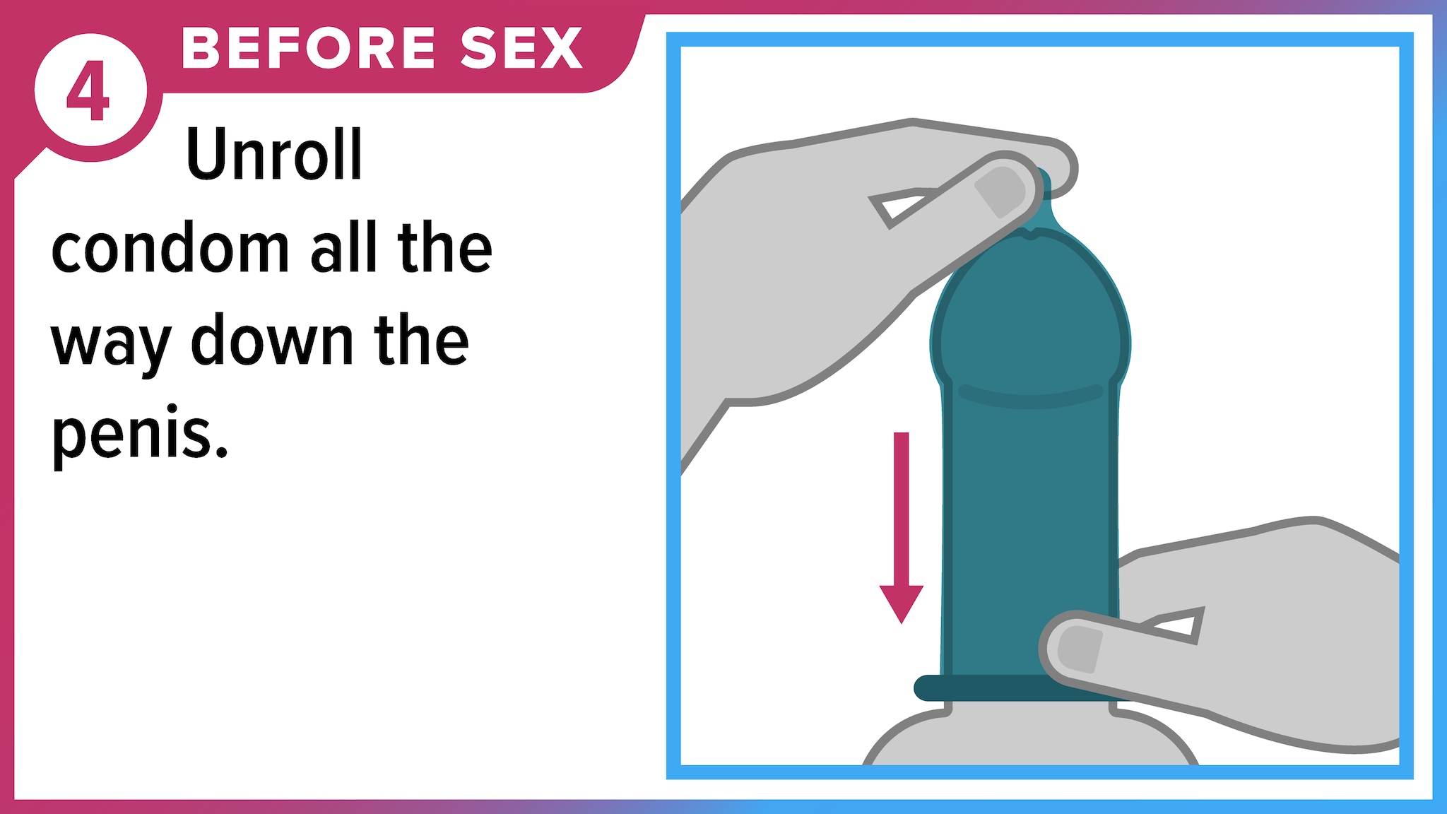 Hand rolling condom down the penis. Before sex, unroll condom all the way down the penis.
