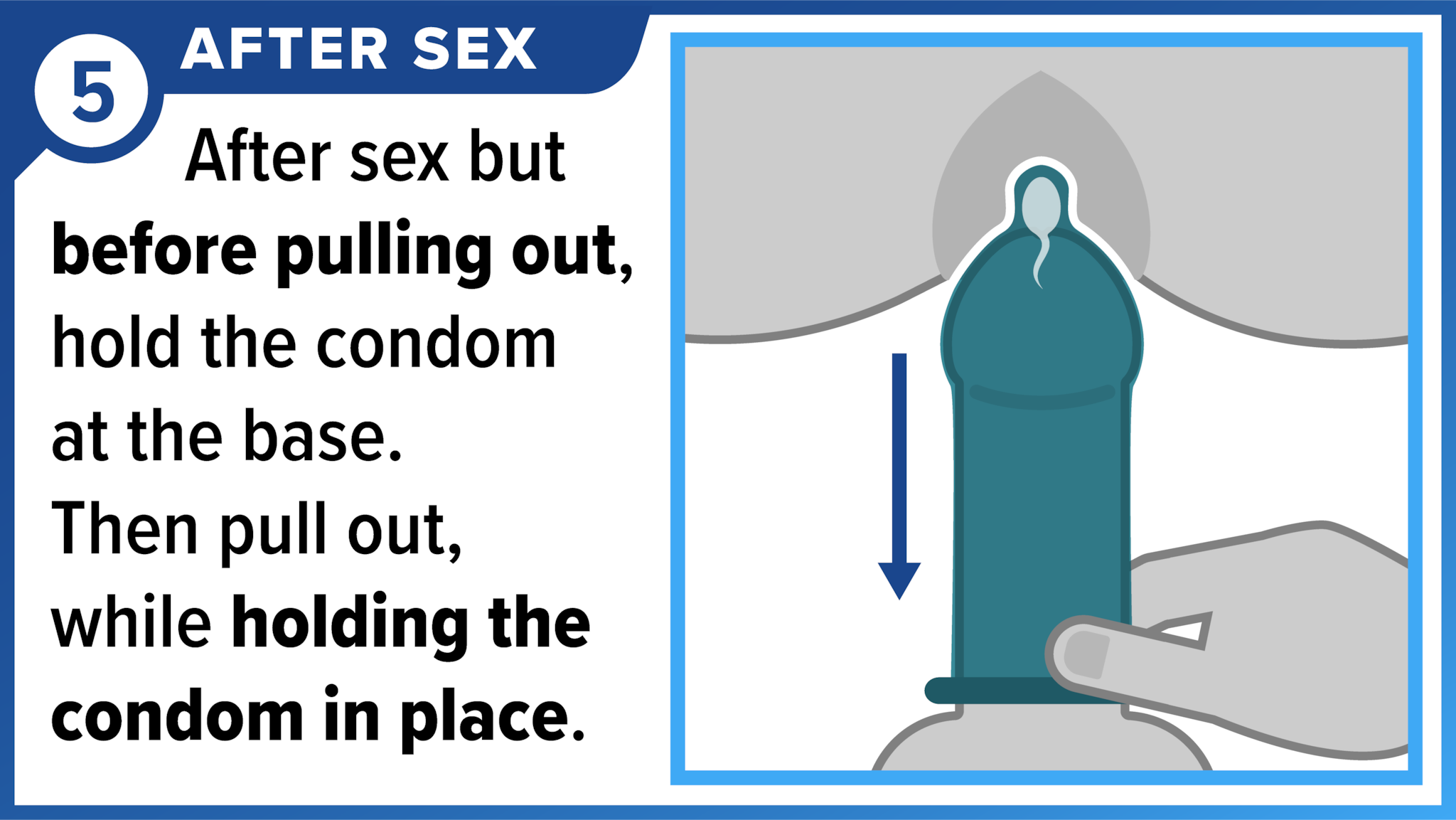 Hand holding the base of the condom while pulling out the penis. After sex - Before pulling out, hold the condom at the base, then pull out while holding the condom in place.