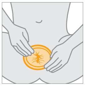 Hands positioning female condom in place to cover vulva.