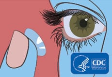 Illustration of a person putting on a contact lens.