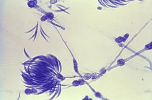 the fungus Fusarium viewed under a microscope.