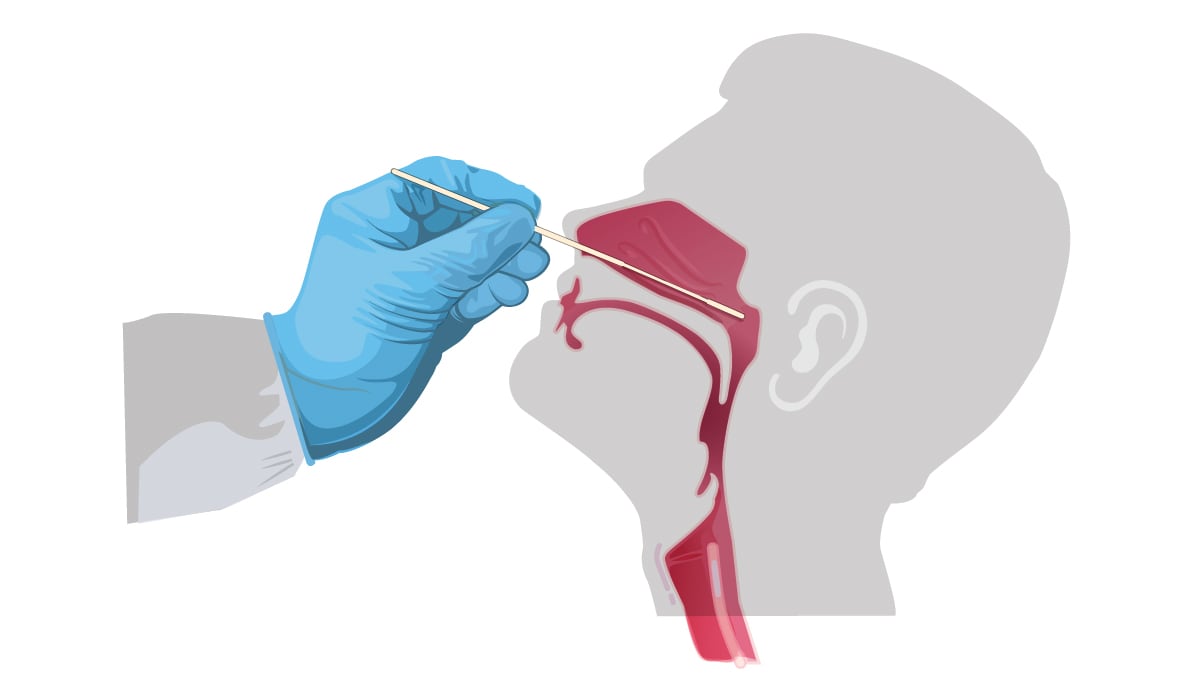 Illustration: swab inserted into nasal cavity