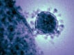 CDC Commentary: Be on the Lookout for MERS-CoV