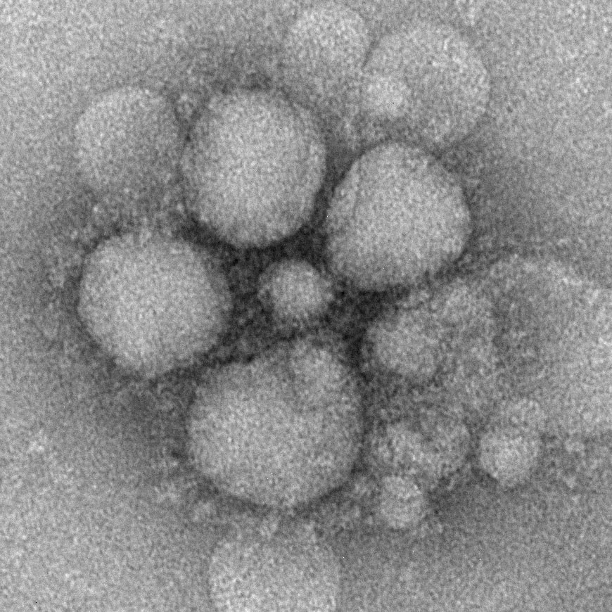 Novel coronavirus particles as seen by negative stain electron microscopy. Virions contain characteristic club-like projections emanating from the viral membrane.