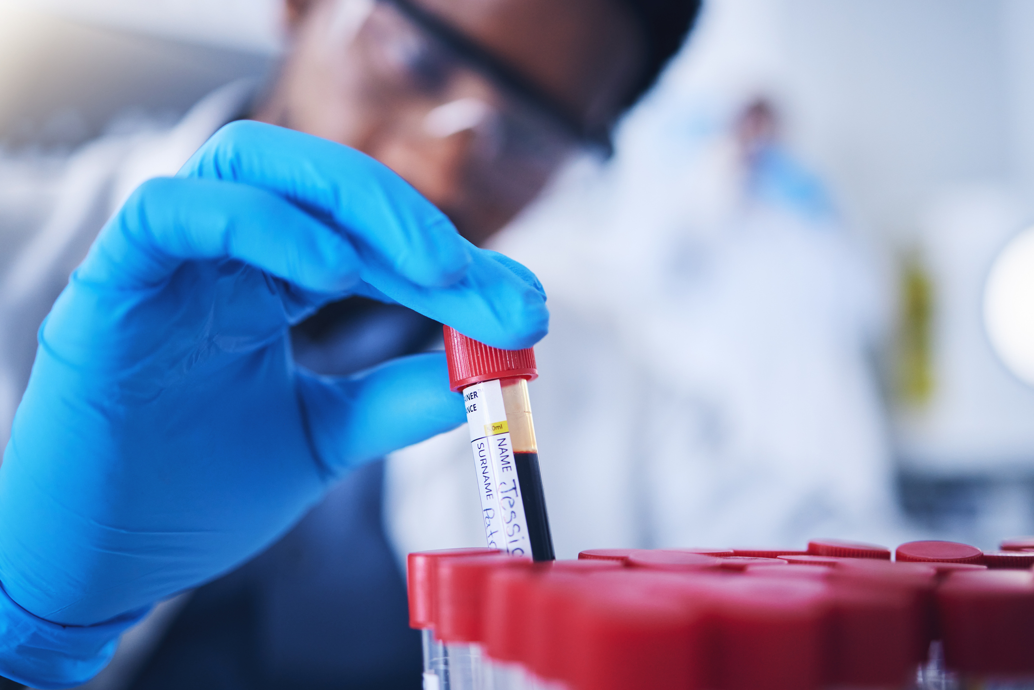 Lab staff with test tube of blood sample