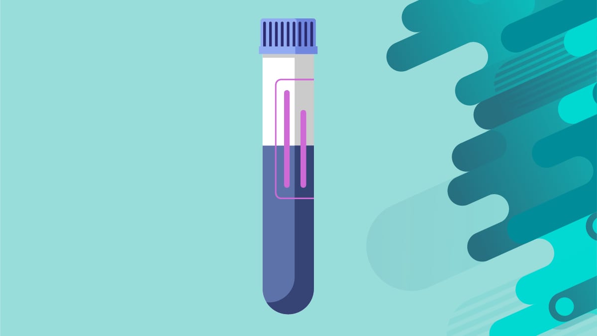 An illustration of a test tube.