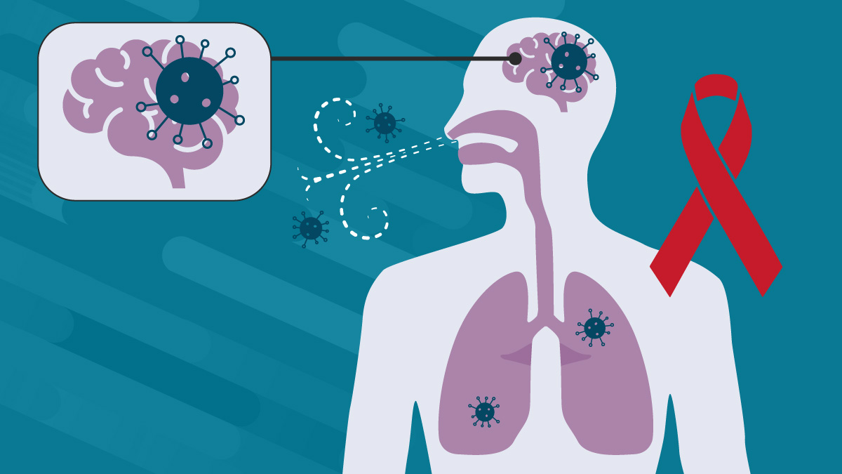 graphic of lung infection with red AIDS ribbon next to it